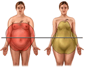 Obesidade e Adiposidade abdominal